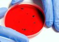 Virus Hanta Ditemukan di Indonesia, Pahami Gejalanya